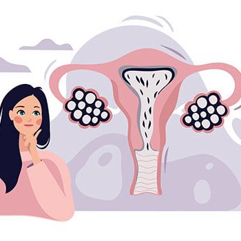 تنبلی تخمدان